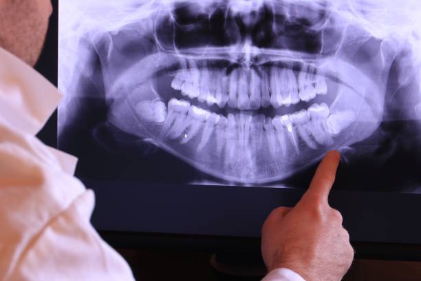 Best After-Hours Dental Trauma Care in Potomac, MD