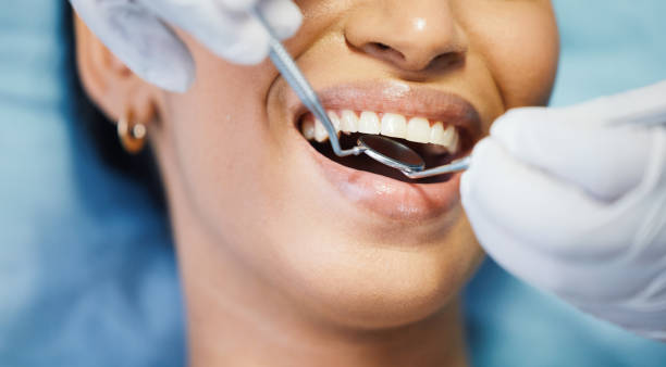 Best Emergency Dental Care for Broken or Chipped Teeth in Potomac, MD