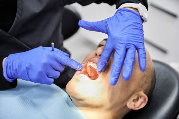 Best Same-Day Emergency Dental Services in Potomac, MD