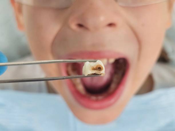 Best 24-Hour Emergency Dentist in Potomac, MD